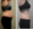 Semaglutide Snellville GA, weight loss injections